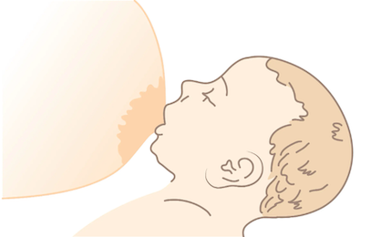 Неправильный захват соска