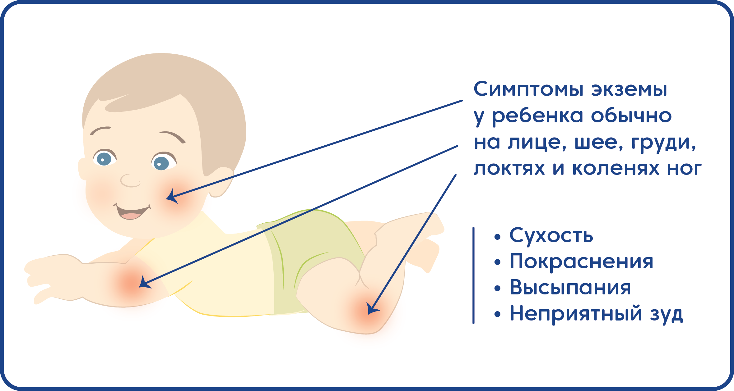 Аллергия на коровью смесь