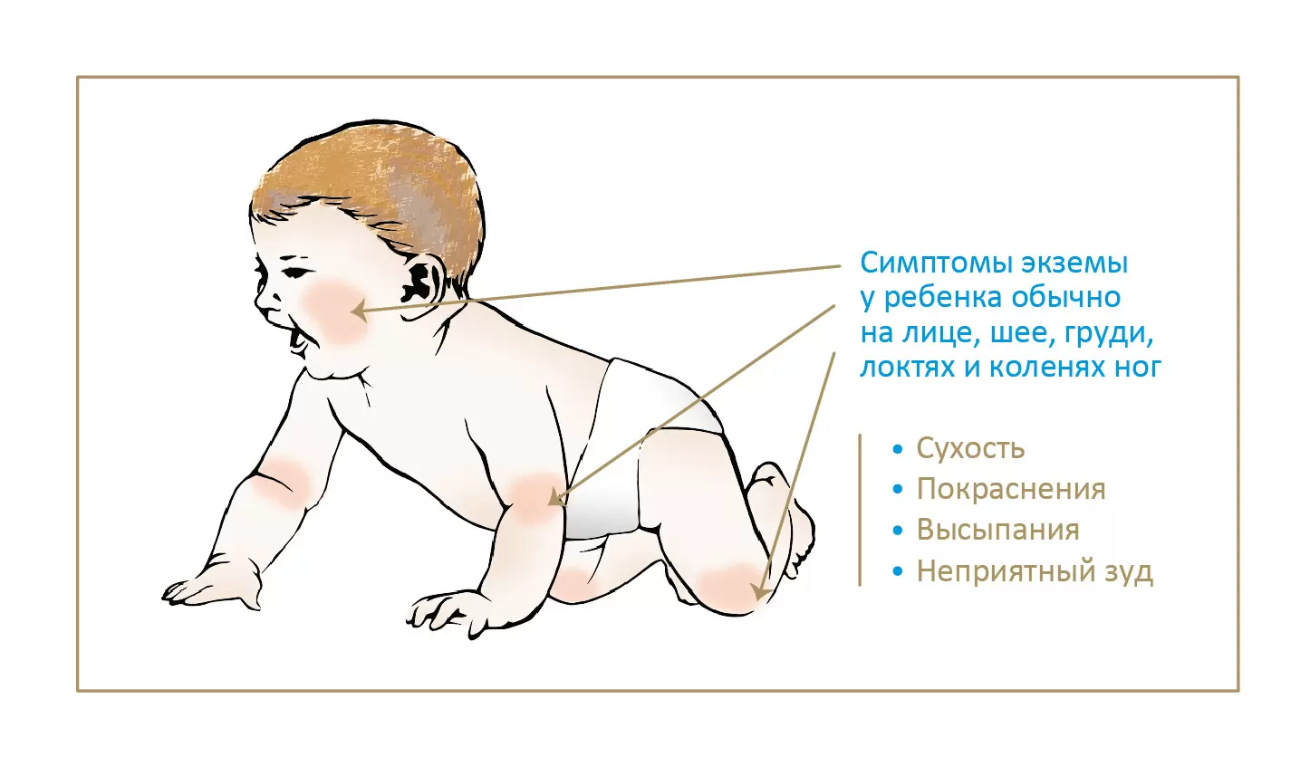 как выглядит дерматит у детей